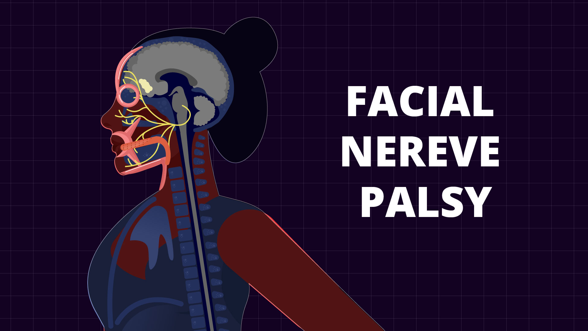 Approach To Facial Nerve Palsy How To Clinically Diagnose Common