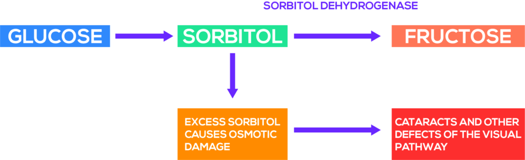 sorbitol and cataract