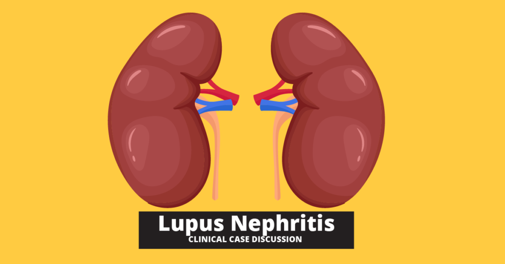 Lupus Nephritis