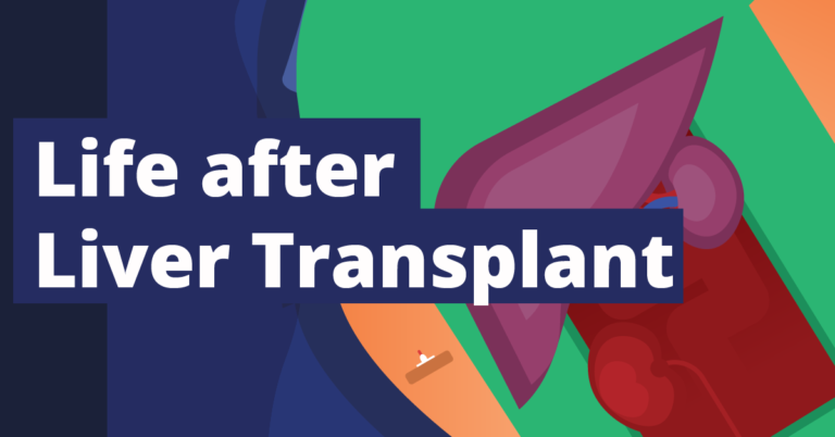 Life Expectancy After Liver Transplant - Tiny Medicine