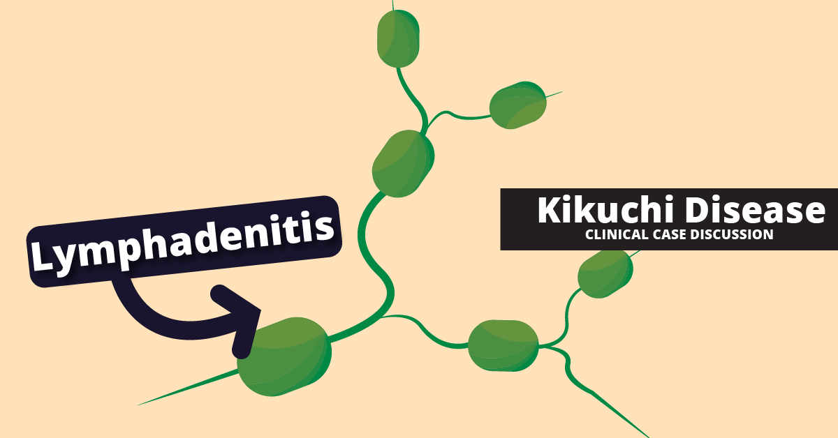 kikuchi disease