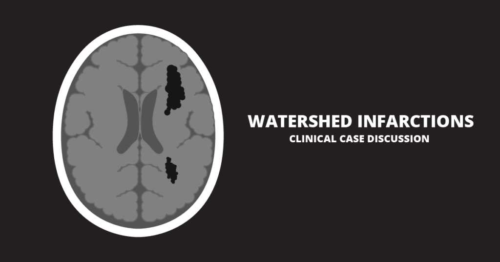 watershed-infarctions-clinical-case-discussion-tiny-medicine