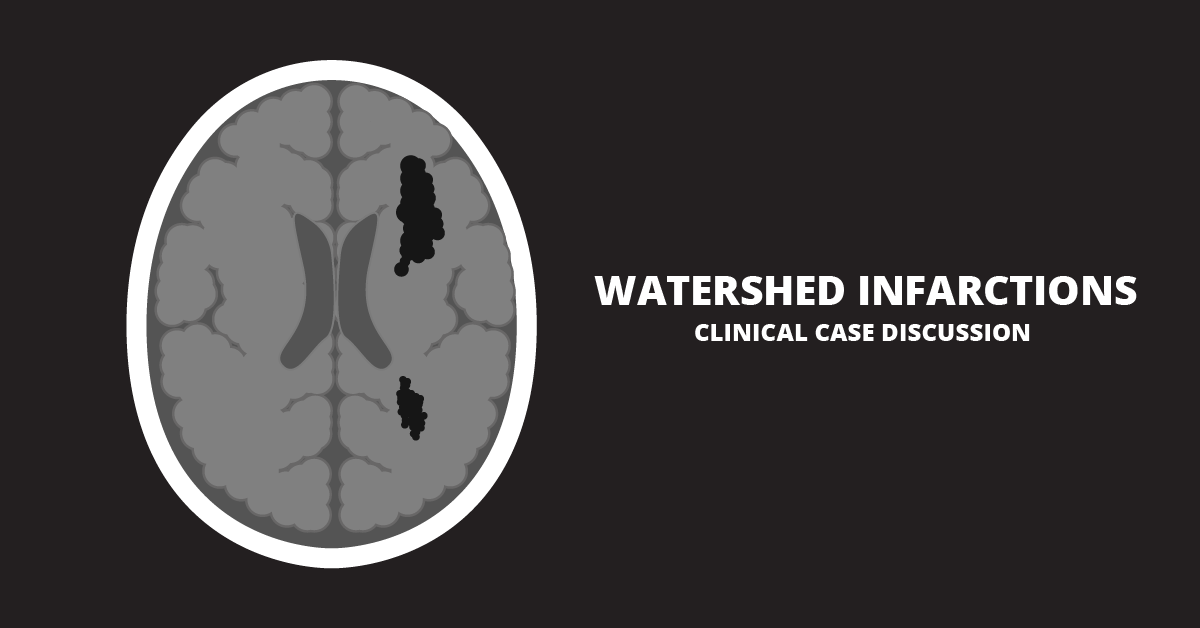 watershed infarction-01