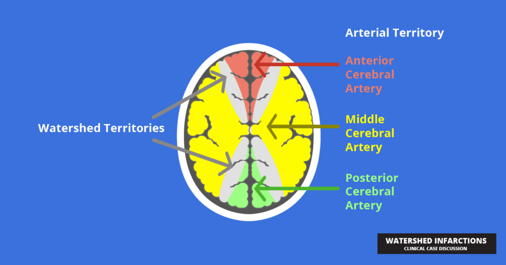 watershed infarction arterieal territory-01