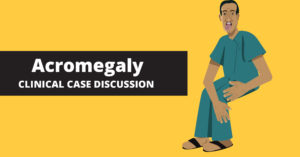 acromegaly