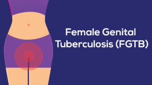 female genital tb-01