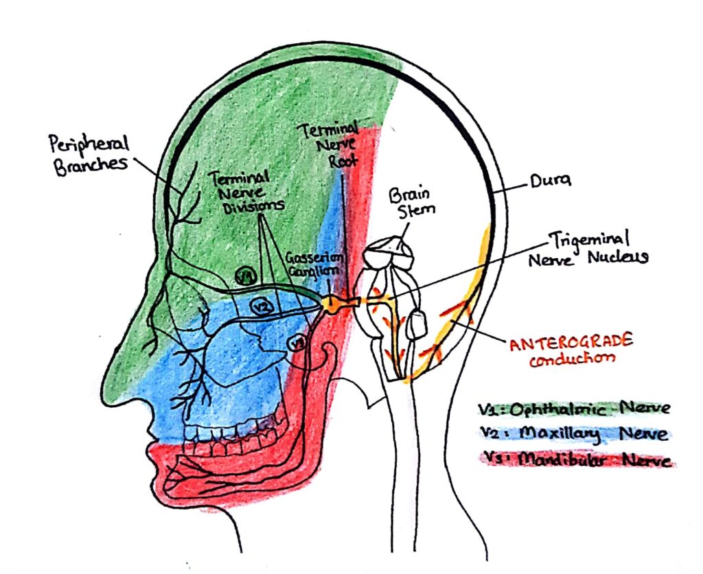 A diagram of the Trigeminal Nerve and each of the 3 sections separated into V1, V2, and V3. 