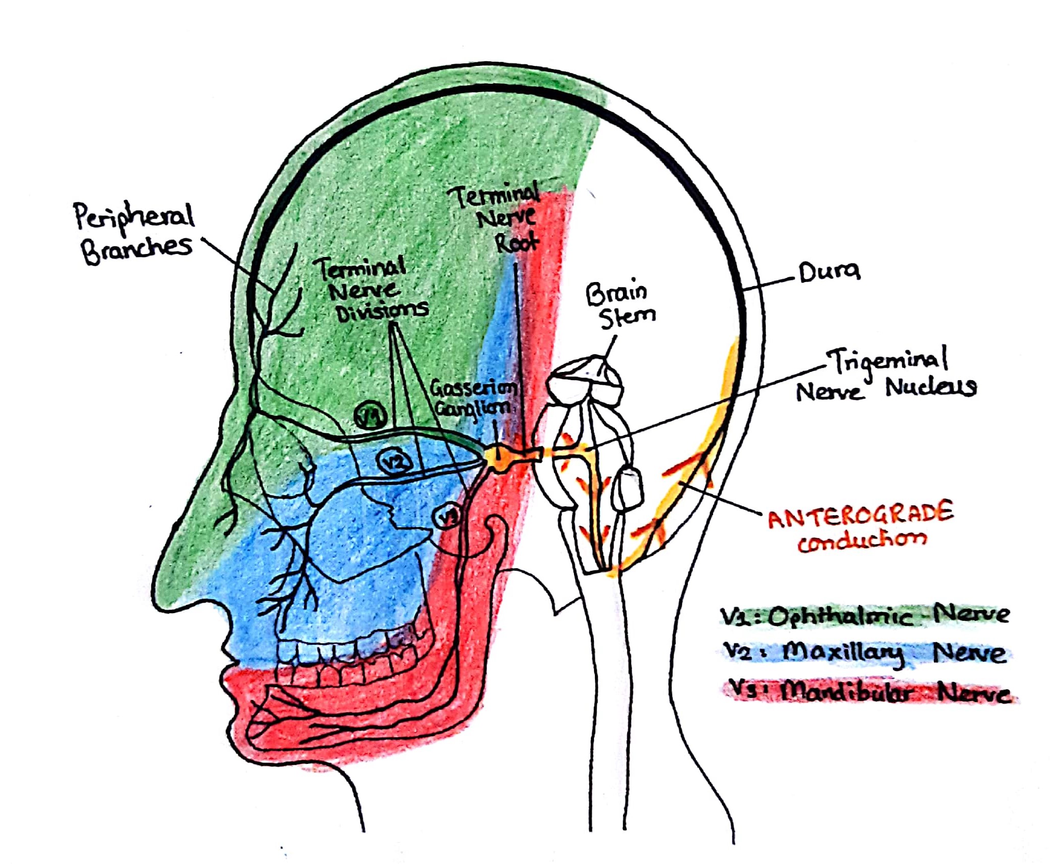 trigeminal neuralgia