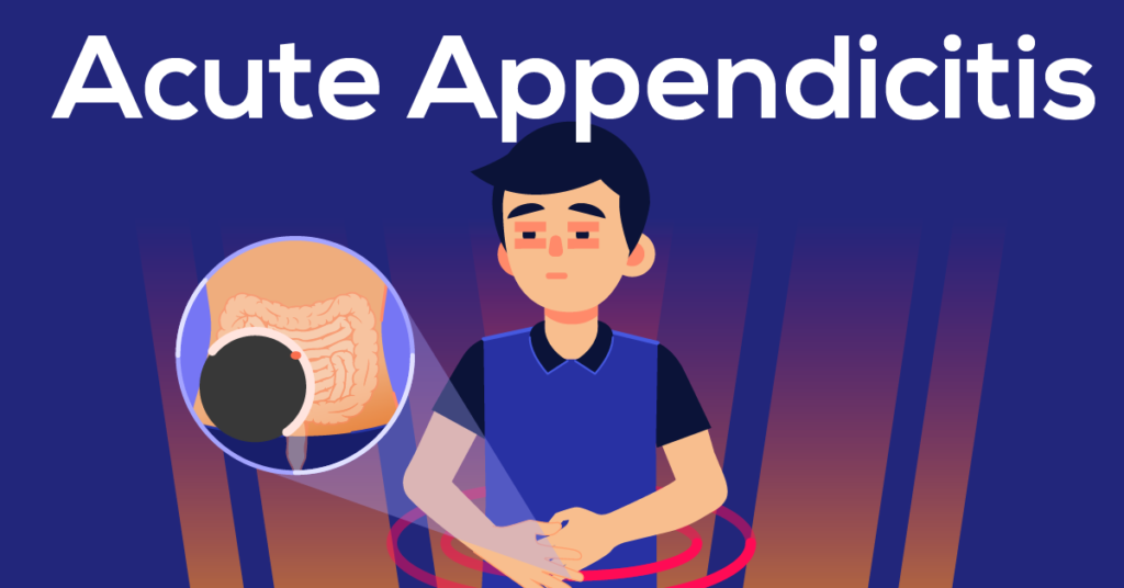 acute appendicitis