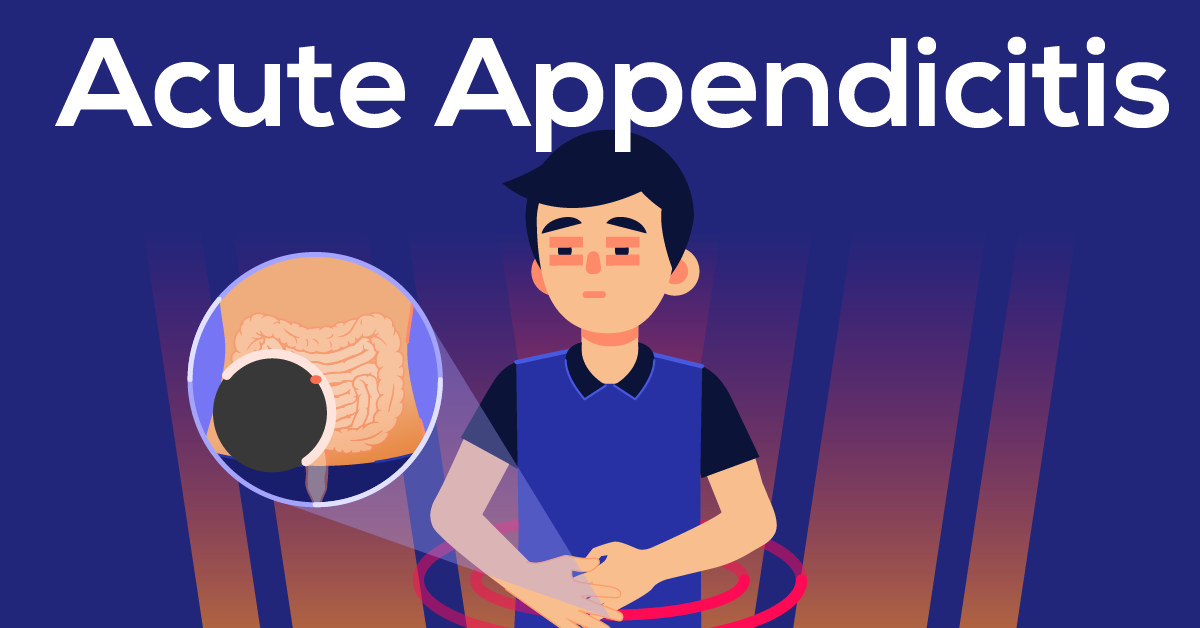 What Is Acute Appendicitis Learn Through A Clinical Case Discussion
